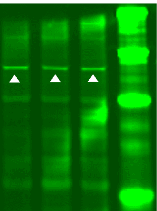 Data image for Quantitative analysis with Empiria Studio was more consistent than local and global background subtraction