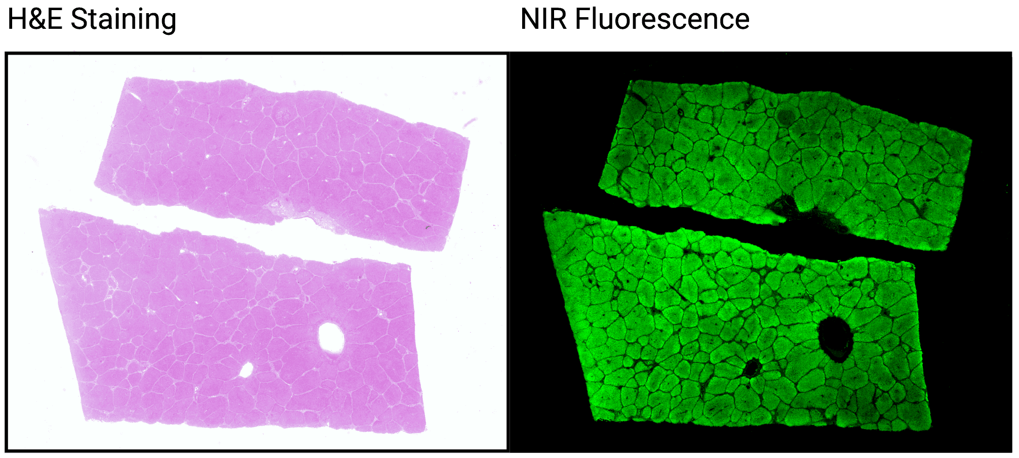 Comparison of H&E Stained slide and a fluorescent slide.